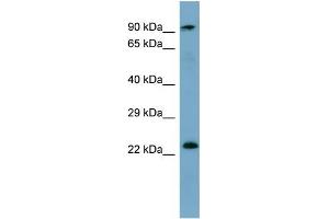 KRAS antibody used at 1 ug/ml to detect target protein. (K-RAS Antikörper  (N-Term))