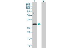 Western Blot analysis of SNRPA expression in transfected 293T cell line by SNRPA MaxPab polyclonal antibody. (SNRPA1 Antikörper  (AA 1-282))