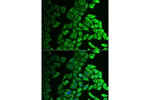 Immunofluorescence analysis of A549 cell using IL18BP antibody. (IL18BP Antikörper)