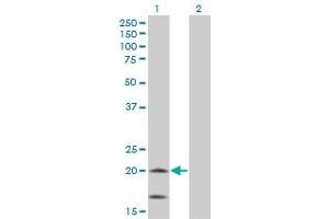 Western Blot analysis of NDUFS4 expression in transfected 293T cell line by NDUFS4 monoclonal antibody (M01A), clone 1A1. (NDUFS4 Antikörper  (AA 66-175))