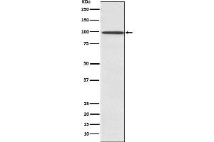 Western blot analysis of SUN1 expression in Ramos cell lysate.