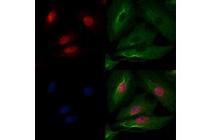 ABIN6259505 and ABIN6275797 staining  cells by IF/ICC. (CHFR Antikörper  (Internal Region))