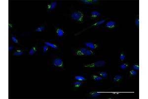 Immunofluorescence of purified MaxPab antibody to GOLM1 on HeLa cell.