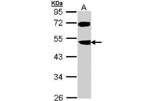 WB Image Sample (30 ug of whole cell lysate) A: Molt-4 , 10% SDS PAGE antibody diluted at 1:1000 (FBXL3 Antikörper)