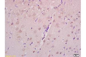 Formalin-fixed and paraffin embedded rat brain tissue labeled with Anti Axin 2 Polyclonal Antibody,Unconjugated (ABIN713696) at 1:200 followed by conjugation to the secondary antibody and DAB staining.