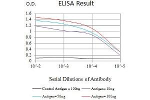 Black line: Control Antigen (100 ng),Purple line: Antigen (10 ng), Blue line: Antigen (50 ng), Red line:Antigen (100 ng) (MME Antikörper  (AA 52-246))