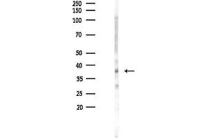anti-SAPK, JNK (pTyr185) antibody