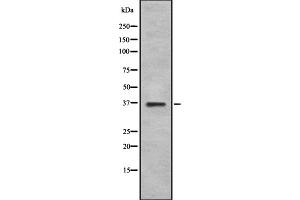 Western blot analysis GS28 using K562 whole cell lysates (GS28 Antikörper  (Internal Region))