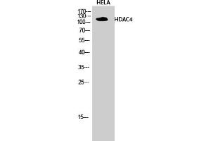 Western Blotting (WB) image for anti-Histone Deacetylase 4 (HDAC4) (Ser632) antibody (ABIN5956852) (HDAC4 Antikörper  (Ser632))