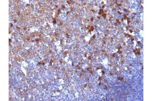 Formalin-fixed, paraffin-embedded human tonsil stained with IgG antibody (IG217) (Maus anti-Human IgG Antikörper)