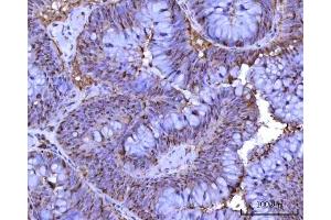 IHC analysis of RRP1 using anti-RRP1 antibody (ABIN7600683).