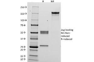 SDS-PAGE Analysis Purified hCG alpha Mouse Monoclonal Antibody (HCGa/53). (CGA Antikörper)