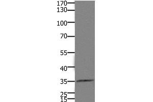 Western Blot analysis of Mouse kidney tissue using HOXD11 Polyclonal Antibody at dilution of 1:1100 (HOXD11 Antikörper)