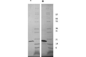 SDS-PAGE of Human Fibroblast Growth Factor-22 Recombinant Protein SDS-PAGE of Human Fibroblast Growth Factor-22 Recombinant Protein. (FGF22 Protein)