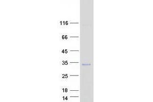 Western Blotting (WB) image for Vesicle Transport through Interaction with T-SNAREs Homolog 1B (VTI1B) protein (Myc-DYKDDDDK Tag) (ABIN2735460)