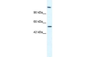 WB Suggested Anti-HELB Antibody Titration:  2. (DNA Helicase B Antikörper  (N-Term))