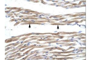 Image no. 1 for anti-Fatty Acid Binding Protein 3, Muscle and Heart (FABP3) (AA 46-95) antibody (ABIN202026) (FABP3 Antikörper  (AA 46-95))