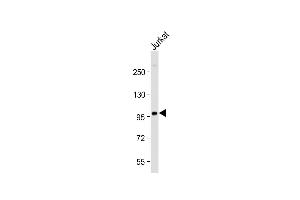 Anti-PI3KR1 Antibody (N-term L11) at 1:2000 dilution + Jurkat whole cell lysate Lysates/proteins at 20 μg per lane.