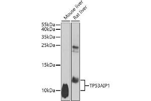 Western blot analysis of extracts of various cell lines, using TP53 antibody (ABIN6130605, ABIN6149411, ABIN6149413 and ABIN6223058) at 1:1000 dilution. (TP53AIP1 Antikörper  (AA 1-108))