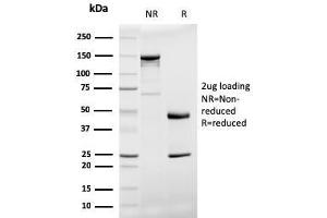 SDS-PAGE (SDS) image for anti-Prohibitin (PHB) (AA 167-261) antibody (ABIN6940306)
