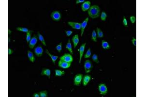 Immunofluorescent analysis of PC-3 cells using ABIN7169873 at dilution of 1:100 and Alexa Fluor 488-congugated AffiniPure Goat Anti-Rabbit IgG(H+L) (SNRPD1 Antikörper  (AA 1-119))