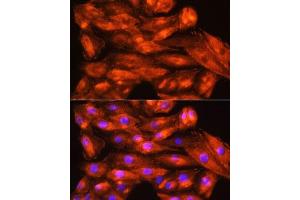 Immunofluorescence analysis of H9C2 cells using ZCCHC11 Rabbit pAb (ABIN6128939, ABIN6150406, ABIN6150407 and ABIN6221650) at dilution of 1:100. (ZCCHC11 Antikörper  (AA 1-290))