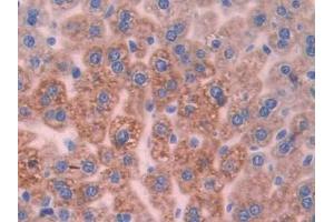 IHC-P analysis of Mouse Liver Tissue, with DAB staining. (UCP2 Antikörper  (AA 150-304))