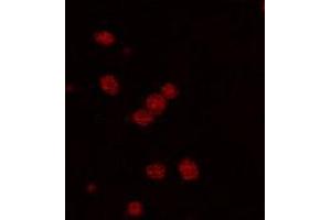 Immunofluorescence staining of PDE2A expressing cell with PDE2A polyclonal antibody . (PDE2A Antikörper  (C-Term))