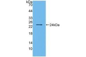 Detection of Recombinant BMF, Human using Polyclonal Antibody to Bcl2 Modifying Factor (BMF) (BMF Antikörper  (AA 1-181))