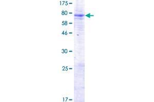 MBOAT7 Protein (AA 1-472) (GST tag)