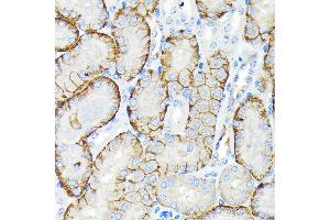 Immunohistochemistry of paraffin-embedded mouse kidney using SLC22/OCT3 Rabbit mAb (ABIN7269107) at dilution of 1:100 (40x lens). (SLC22A3 Antikörper)
