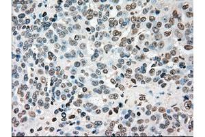 Image no. 2 for anti-Checkpoint Kinase 2 (CHEK2) antibody (ABIN1497498) (CHEK2 Antikörper)