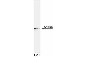 Western blot analysis of Cytokeratin 7. (Cytokeratin 7 Antikörper)