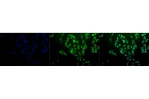 Immunocytochemistry/Immunofluorescence analysis using Rabbit Anti-Ubiquitin Polyclonal Antibody (ABIN361830 and ABIN361831). (Ubiquitin Antikörper)