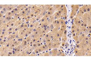 Immunohistochemistry (IHC) image for anti-Neuropilin 1 (NRP1) (AA 646-814) antibody (ABIN7425992)