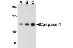 Western blot analysis of Caspase-1 in human heart cell lysate with AP30187PU-N Caspase-1 antibody at (A) 0. (Caspase 1 Antikörper  (C-Term))