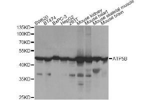 Western blot analysis of extracts of various cell lines, using ATP5B Antibody (ABIN5973391) at 1/1000 dilution.