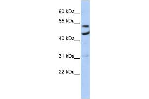 WB Suggested Anti-CNOT6 Antibody Titration:  0. (CNOT6 Antikörper  (N-Term))