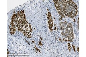 IHC analysis of PTBP2 using anti-PTBP2 antibody (ABIN7599454).