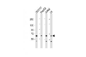 All lanes : Anti-PDP1 Antibody (Center) at 1:2000 dilution Lane 1: 293T/17 whole cell lysate Lane 2: HepG2 whole cell lysate Lane 3: Jurkat whole cell lysate Lane 4: L6 whole cell lysate Lysates/proteins at 20 μg per lane. (PDP Antikörper  (AA 308-336))
