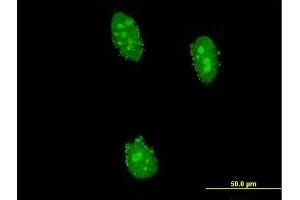 Immunofluorescence of monoclonal antibody to UHRF2 on HeLa cell. (UHRF2 Antikörper  (AA 81-180))