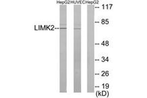 Western blot analysis of extracts from HepG2/HuvEc cells, using LIMK2 Antibody. (LIMK2 Antikörper  (AA 461-510))