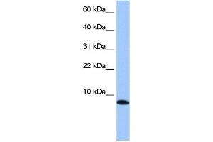 TNP1 antibody used at 1 ug/ml to detect target protein. (TNP1 Antikörper)