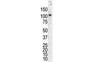 Western Blotting (WB) image for anti-Protein Kinase D3 (PRKD3) (AA 352-384) antibody (ABIN3032380)