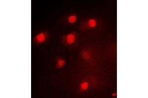 Immunofluorescent analysis of PAX3 staining in Hela cells.