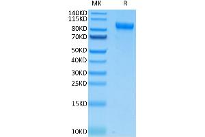 SDS-PAGE (SDS) image for CUB Domain Containing Protein 1 (CDCP1) (AA 25-667) protein (His tag) (ABIN7274296)