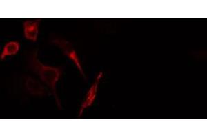 ABIN6266907 staining HuvEc cells by IF/ICC. (GUCY1B3 Antikörper  (N-Term))