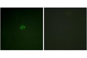 Immunofluorescence analysis of A549 cells, using 4E-BP1 (Ab-36) Antibody. (eIF4EBP1 Antikörper  (AA 2-51))