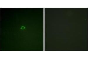 Immunofluorescence analysis of A549 cells, using 4E-BP1 (Ab-36) Antibody. (eIF4EBP1 Antikörper  (AA 2-51))