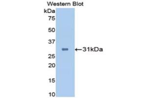 Western Blotting (WB) image for anti-Carbonic Anhydrase II (CA2) (AA 1-260) antibody (ABIN1173596) (CA2 Antikörper  (AA 1-260))